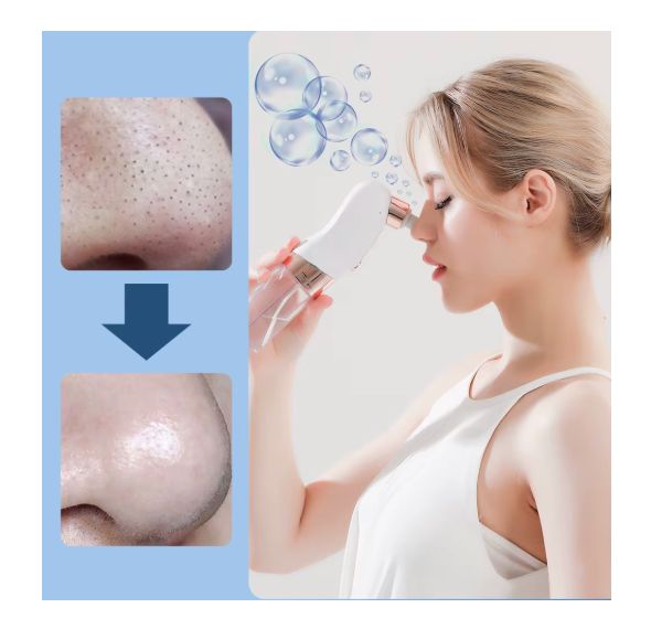 Small Bubble Facial Blackhead Removal Vacuum Face Cleaner Hydra Dermabrasion Hydro Skin Deep Clean Care anti Aging Beautymachine